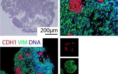 DFG funds new Research Training Group on Tumor Organoids in Ulm
