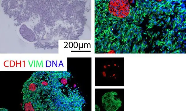 DFG funds new Research Training Group on Tumor Organoids in Ulm