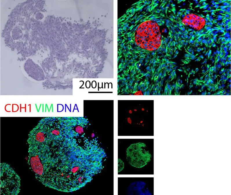 DFG funds new Research Training Group on Tumor Organoids in Ulm