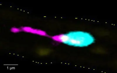 Würzburg researchers discover pro-inflammatory mechanism in platelets