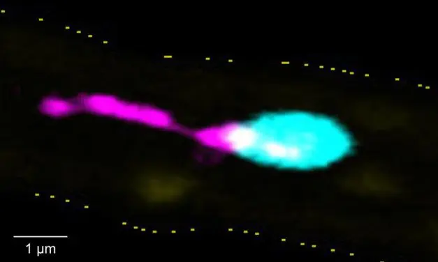 Würzburg researchers discover pro-inflammatory mechanism in platelets