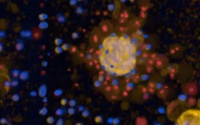 Tumoroids from lung cancer tissue enable testing of therapies