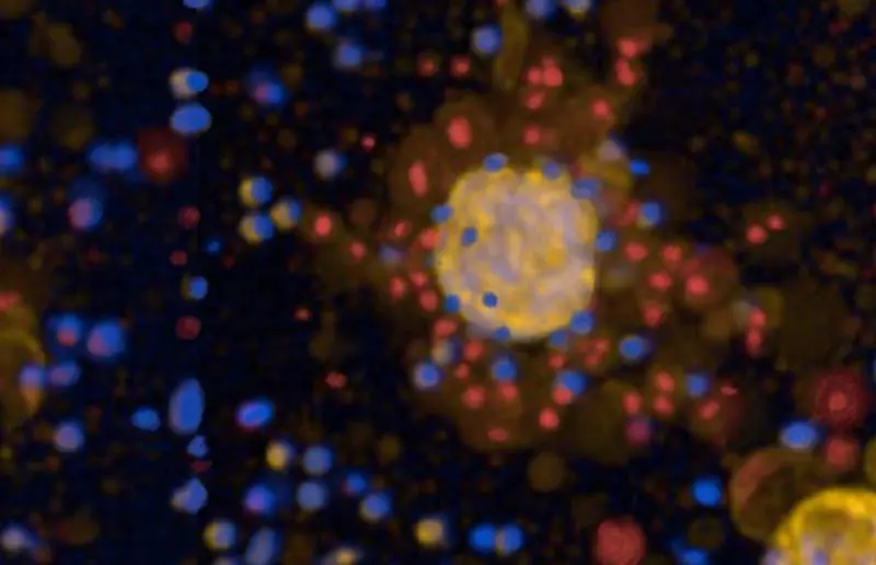 Tumoroids from lung cancer tissue enable testing of therapies