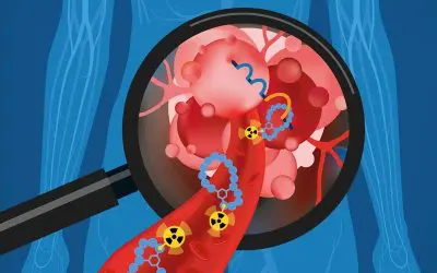 Bladder Cancer: Precision Diagnostics with Peptides