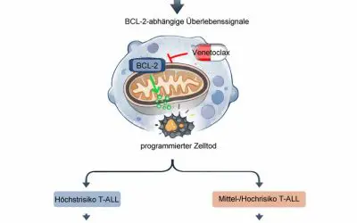 Hope for T-cell leukemia in childhood