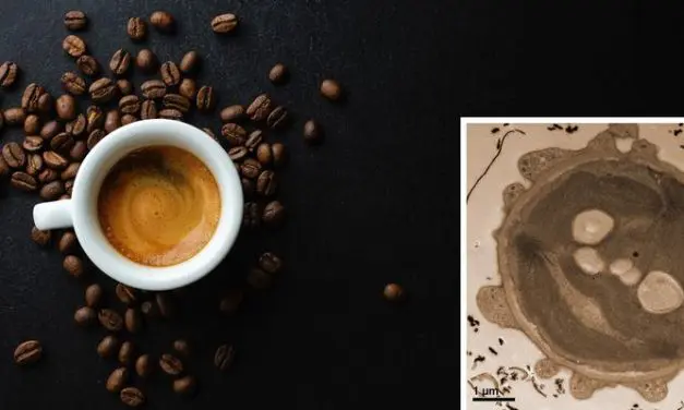 Electron microscopy: Espresso as an environmentally friendly alternative to uranyl acetate