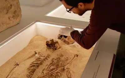 Paleogenomics diagnoses rare growth disorder in 12,000-year-old skeletons