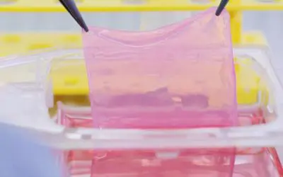 Crans Montana: Biotechnologically grown skin grafts for burn victims