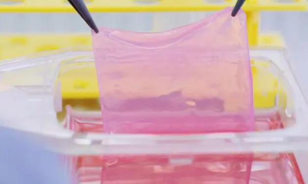 Crans Montana: Biotechnologically grown skin grafts for burn victims