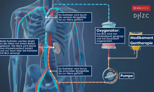 Researchers develop system for the targeted treatment of individual organs