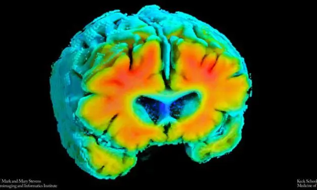 New markers could detect Alzheimer’s risk at an early stage