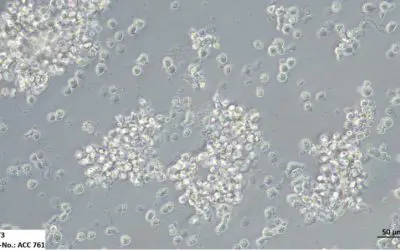 INTRODUCING: The World’s Largest Collection of Leukemia and Lymphoma Cell Lines for Cancer Research