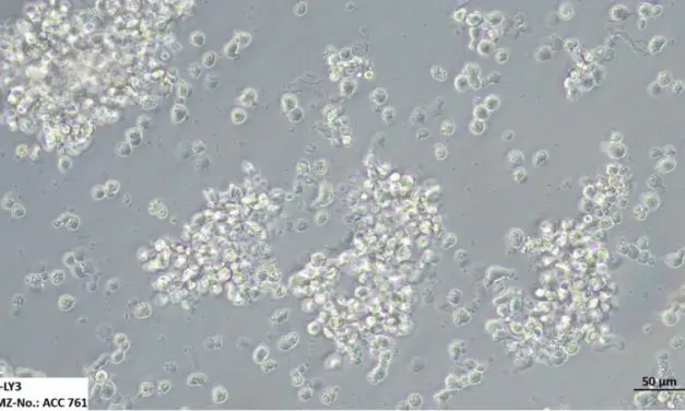 INTRODUCING: The World’s Largest Collection of Leukemia and Lymphoma Cell Lines for Cancer Research