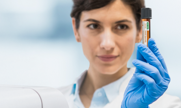 Intelligent quality control for your Roche system: Discover Bio-Rad InteliQ