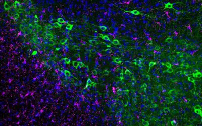 Immunotherapy could stop neuron loss in Parkinson’s disease