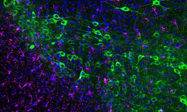 Immunotherapy could stop neuron loss in Parkinson’s disease