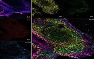 Microfluidics system developed for more reliable super-resolution microscopy of cells
