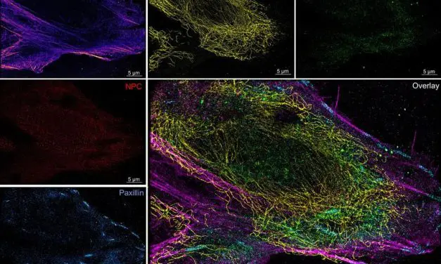 Microfluidics system developed for more reliable super-resolution microscopy of cells