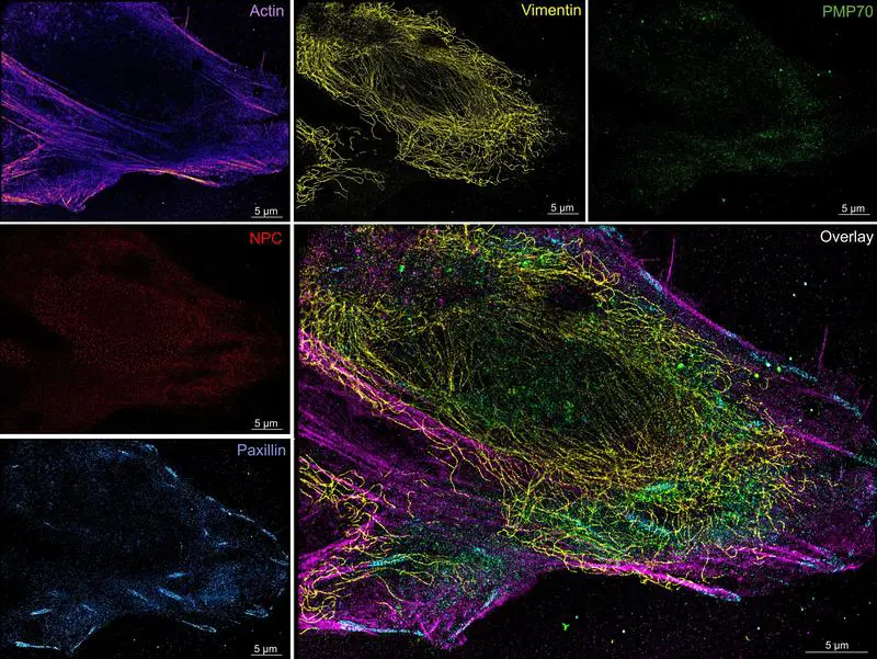 Microfluidics system developed for more reliable super-resolution microscopy of cells