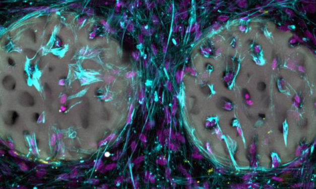 Laser-structured hydrogel as a promising bone implant