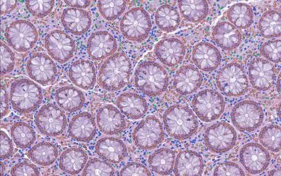Open-source tool LazySlide facilitates AI analysis of tissue images