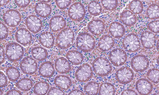 Open-source tool LazySlide facilitates AI analysis of tissue images