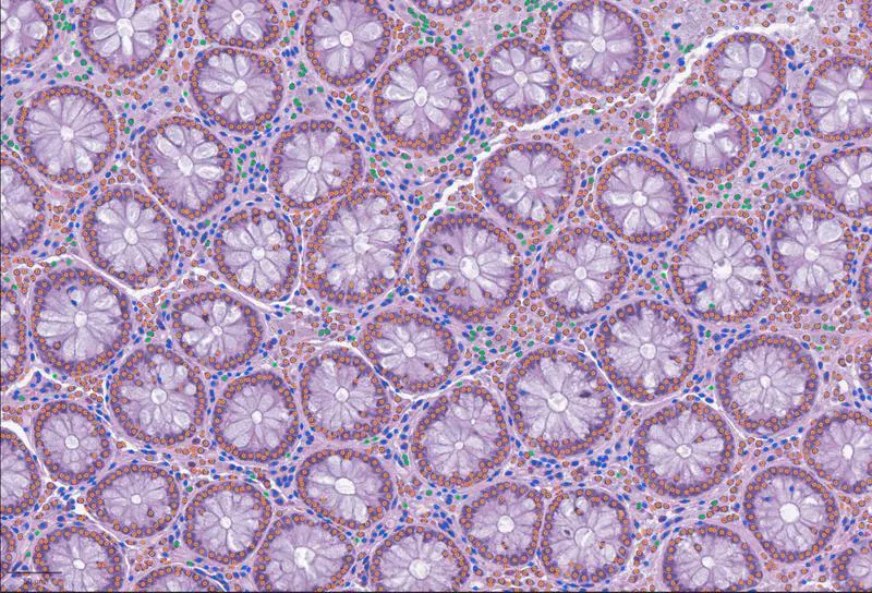 Open-source tool LazySlide facilitates AI analysis of tissue images