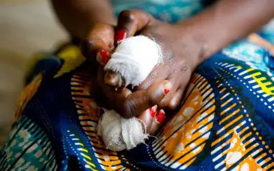 AI-based smartphone app for early detection of neglected tropical skin diseases