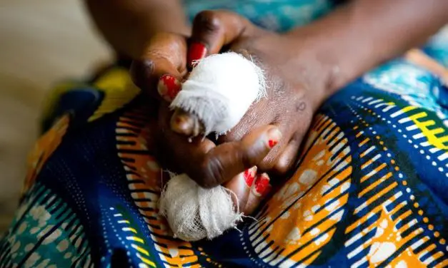 AI-based smartphone app for early detection of neglected tropical skin diseases