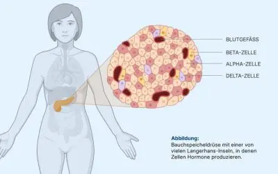 Explainable AI reveals hidden tissue changes in type 2 diabetes