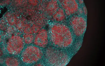 Sildenafil shows promising effect in Leigh syndrome