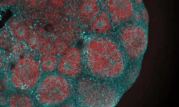 Sildenafil shows promising effect in Leigh syndrome