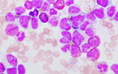 Physicians weaken leukemia cells through targeted false alarm response