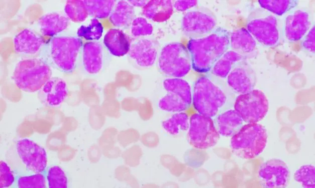 Physicians weaken leukemia cells through targeted false alarm response