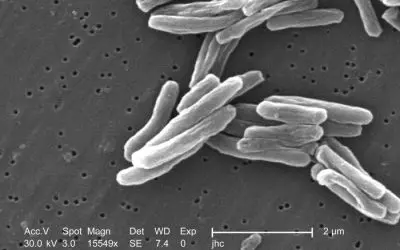 Long-term chances of cure for multidrug-resistant tuberculosis significantly higher than expected