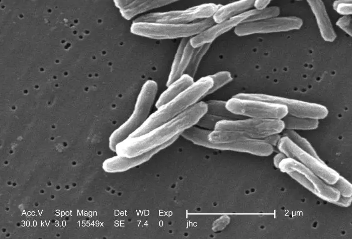 Blood test could improve early detection of tuberculosis in household contacts