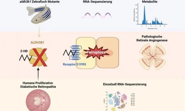 New mechanism of pathological vascularization discovered in diabetic eye