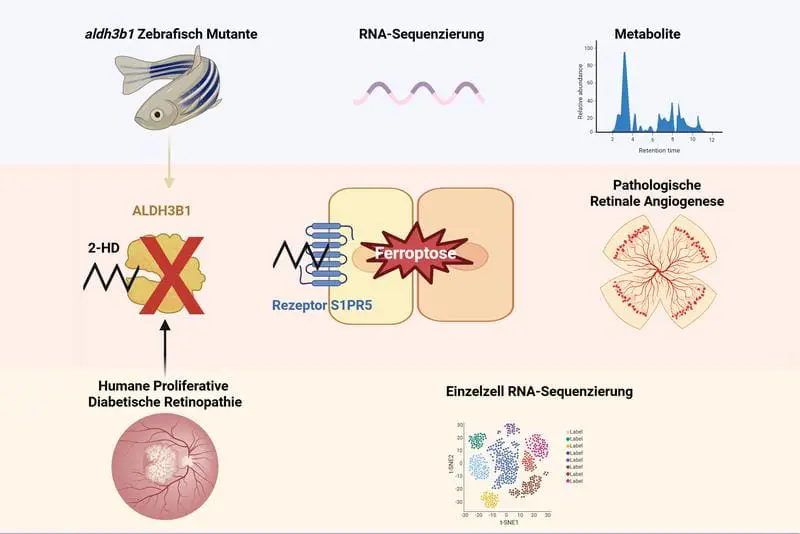 New mechanism of pathological vascularization discovered in diabetic eye