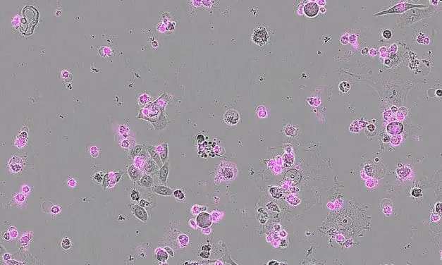 New CRISPR technology with Cas12a2 enables targeted killing of unwanted cells