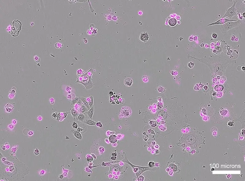 New CRISPR technology with Cas12a2 enables targeted killing of unwanted cells