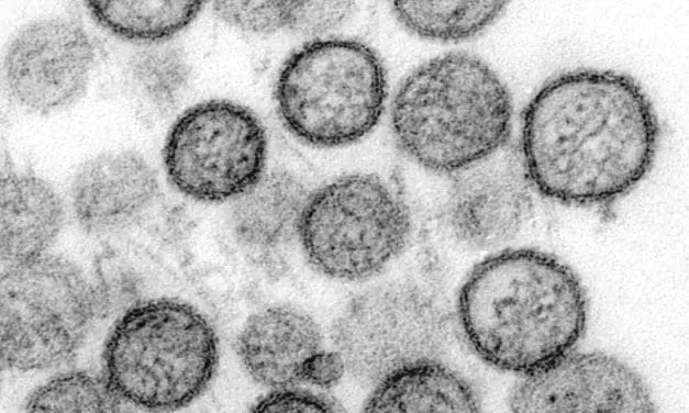 Hantavirus: detection, symptoms, therapy