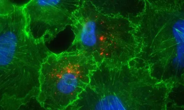 Hantavirus: Experts at the University Medical Center Essen see low risk for the general population