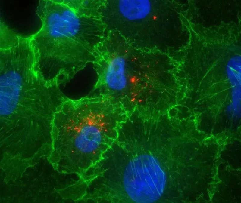 Hantavirus: Experts at the University Medical Center Essen see low risk for the general population