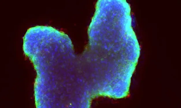CHEM-SCAN to make chemoresistance in tumors visible