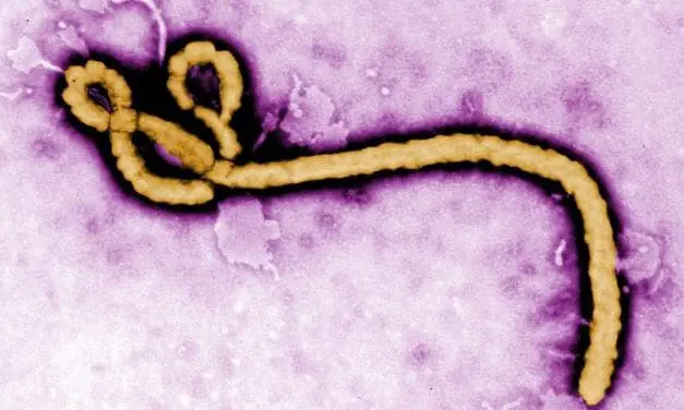 Ebola outbreak: No vaccine, limited diagnostic options