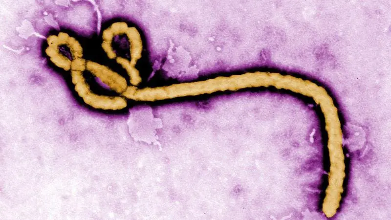 Ebola outbreak: No vaccine, limited diagnostic options
