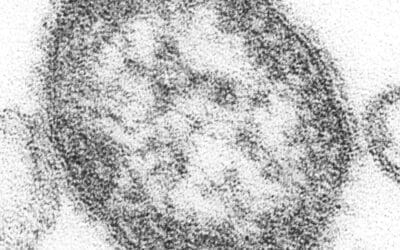 Measles: Vaccination gaps in small children alarm health insurance companies