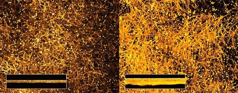 Sensation: Albumin triggers fungal virulence