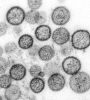 Hantavirus. Credits: CDC