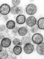 Hantavirus. Credits: CDC
